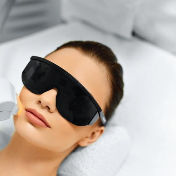 لیزر موهای زائد